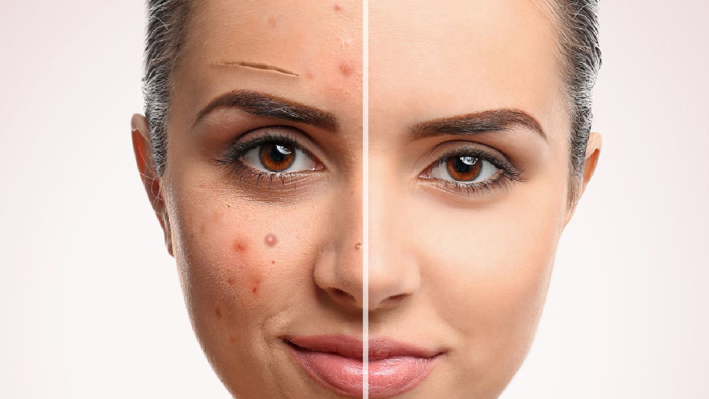 Skin Concerns